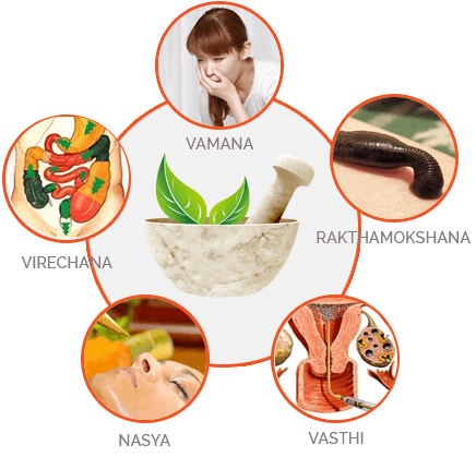 Ayurchaitanyam Hospital - Panchakarma , Ayurvedic Treatment 